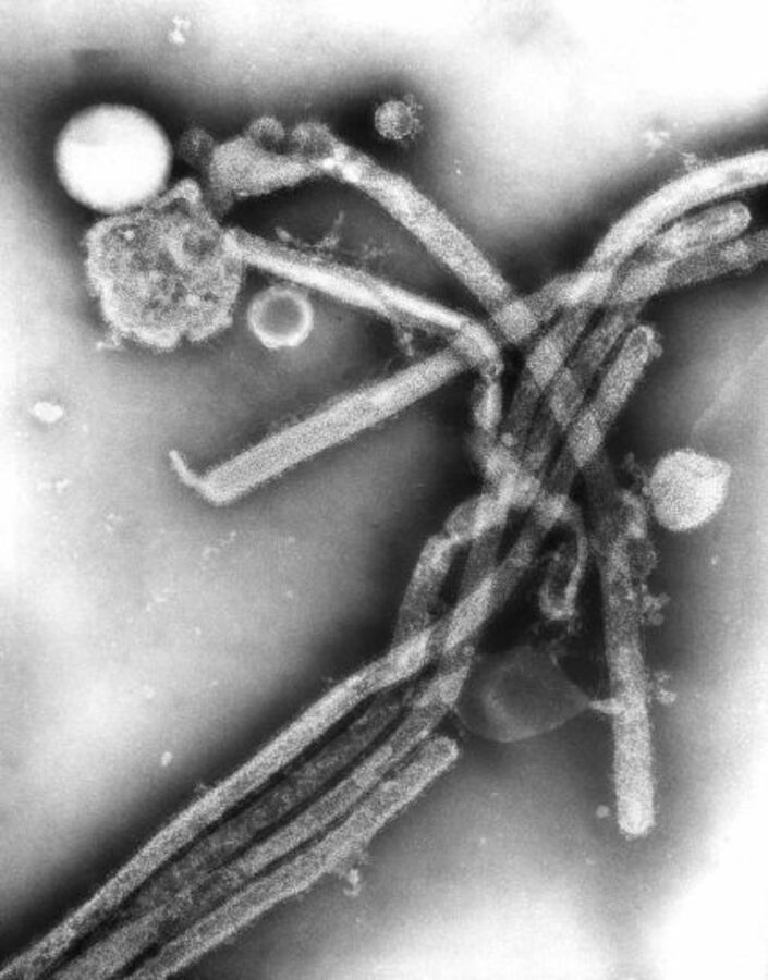 Coronavirus retour sur les plus grandes épidémies et pandémies de l