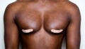 Ever Wondered Why Men Have Nipples?