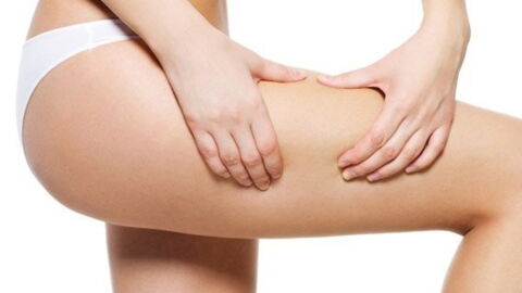 Water Retention (Oedema): Causes, Symptoms, Treatment, Remedies