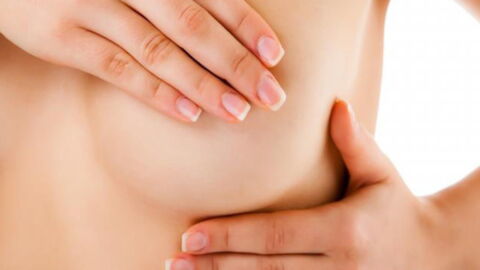 Breast Cancer: Symptoms, Signs, Causes, Stages, Treatment, Survival Rate