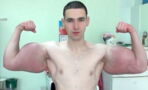 After Regularly Injecting Himself With Synthol, This Man Suffered Some Bizarre Side Effects