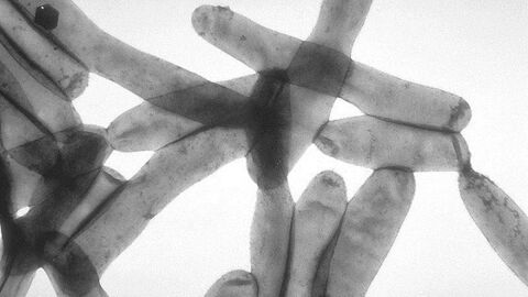 What Is Legionnaires’ Disease? Symptoms, Testing, Prevention, Causes