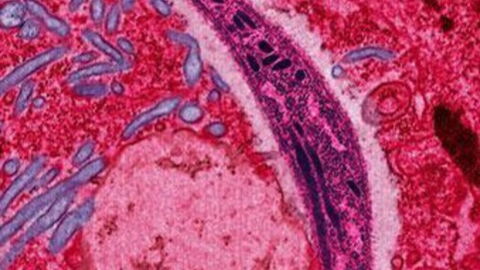 What Is Malaria? Symptoms, Treatment, Prevention