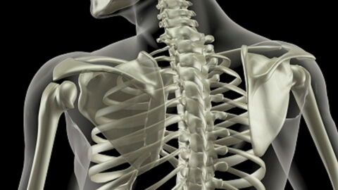 Osteoporosis: Definition, Symptoms, Causes, Pains, Treatment