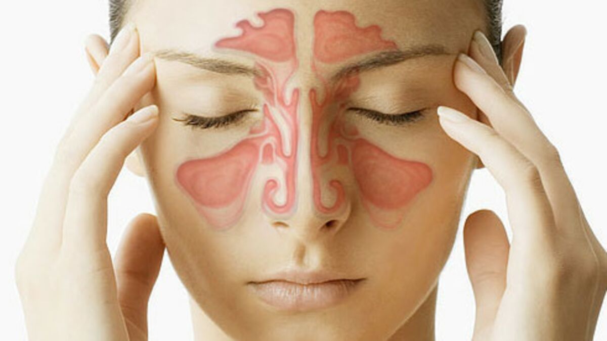 Sinusitis Sinus Infection Symptoms Causes Pressure Headache Treatment Relief Cures