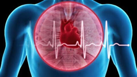 Arrhythmia (Irregular Heartbeat): Meaning, Definition, Causes, Symptoms, Treatment