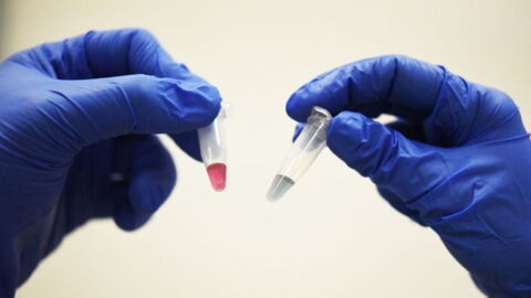 This Simple Blood Test Could Detect Every Type Of Cancer In Just A Few Minutes