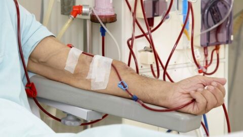 What's Dialysis? Peritoneal And Hemodialysis