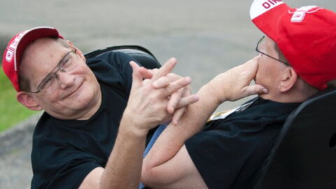 At 68 the world’s oldest living conjoined twins refused to be separated