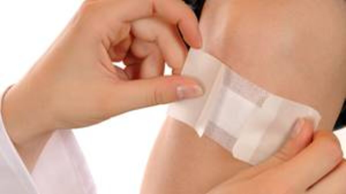 Bedsores Definition, Stages, Prevention, Treatment