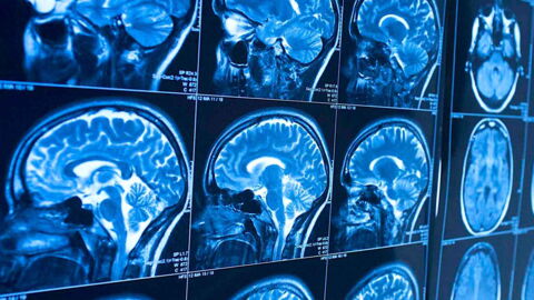 Study Reveals The One Thing You Must Do To Protect Your Brain