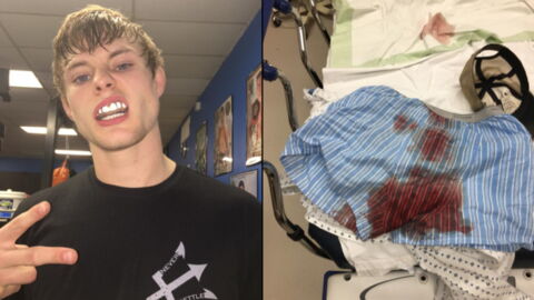 UFC Fighter Bryce Mitchell TEARS His Testicles Off In A Domestic Accident