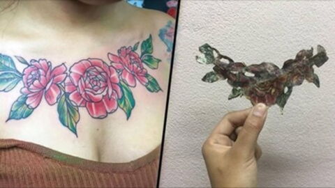 She Tried to Remove Her Tattoo With Cream and It Went Horribly Wrong