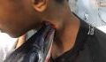 A needlefish attacked and pierced this teenager's neck