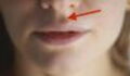 Philtrum: Where does the dimple between the nose and mouth come from?