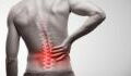 These three exercises can help prevent back pain