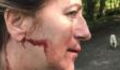 One Dog Walker Got Knocked Out for Having Her Dog Off It's Lead