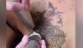 A Woman Tried To Remove Her Chest Tattoo And The Outcome Is Horrific