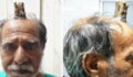 This Man Had A 4-Inch 'Devil Horn' Growing Out Of His Head