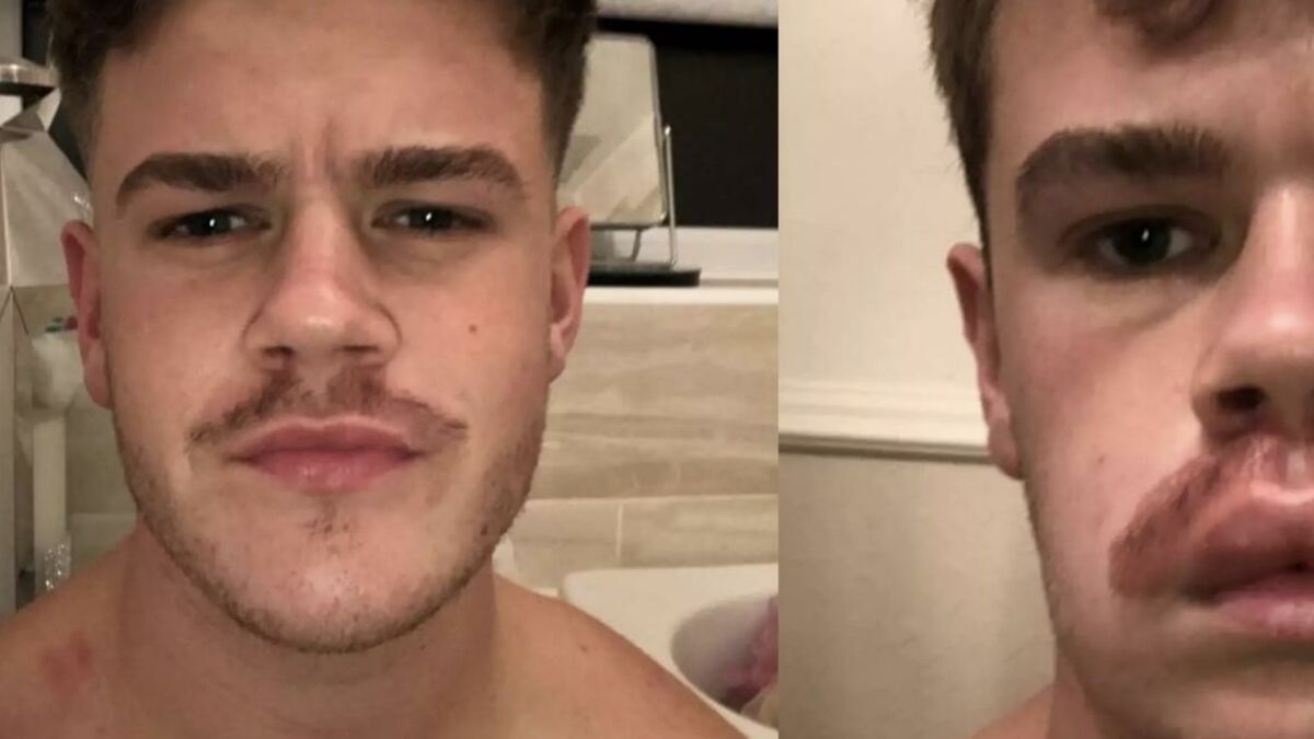 Guy Dyes His Moustache For Movember And Immediately Regrets It