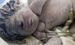 Egyptian woman gives birth to rare 'cyclops' baby