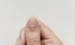 Nail health: Do you have striated nails? This is what that means