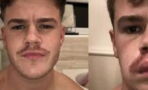 Guy Dyes His Moustache For Movember And Immediately Regrets It