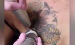 A Woman Tried To Remove Her Chest Tattoo And The Outcome Is Horrific