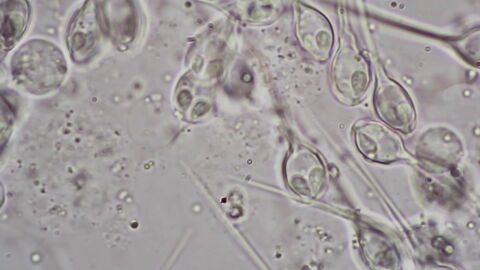 Scientists have discovered the first animal to survive without oxygen