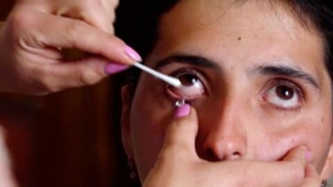 Rare condition makes this Armenian woman cry up to 50 crystals every day