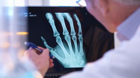 This weird change is happening to our bodies from using our smartphones too much