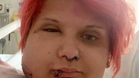 Woman’s face swells to twice the size after brushing against this toxic plant