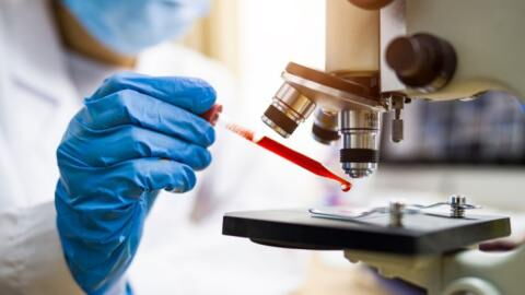 What Does COVID-19 Look Like Under a Microscope?