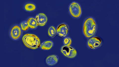 Coronavirus may have triggered a Black Death-like fungal pandemic