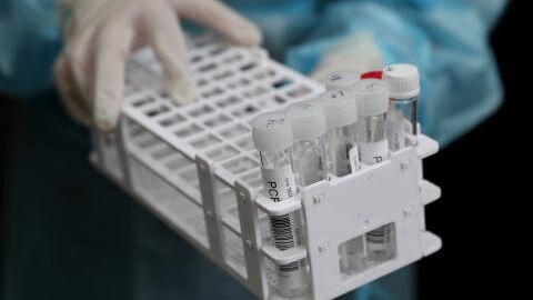 COVID: The protection from booster dose weakens very quickly, study suggests