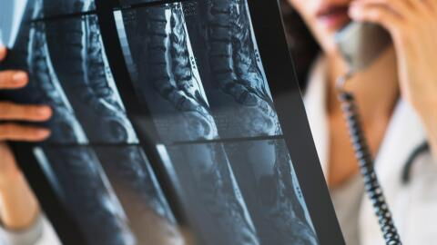 She swallowed her mobile phone to save her relationship!