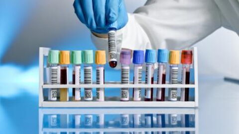 This revolutionary blood test could predict if you'll die within 10 years of taking it