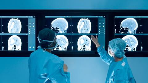 Researchers reveal the surprising motions in the brain while the heart pumps blood