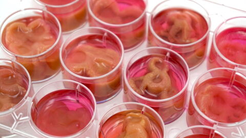 Scientists have discovered a method to create edible steak made from human cells