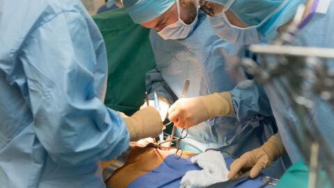 Doctors remove 156 kidney stones from man’s stomach