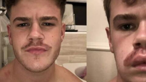 Guy Dyes His Moustache For Movember And Immediately Regrets It