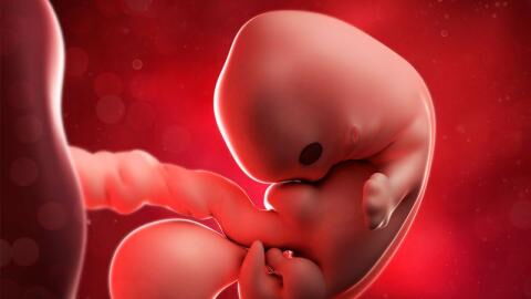 Doctors Discovered Something Unusual in one Teenager's Stomach and it Turned Out to be Her Twin