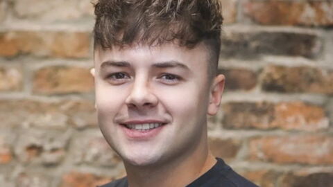 UK man warns others after £1,200 hair transplant left him badly scarred