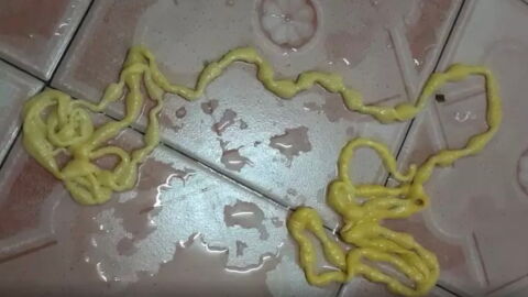 Man left disturbed after pulling 5 metre 'alien' tapeworm from his rear
