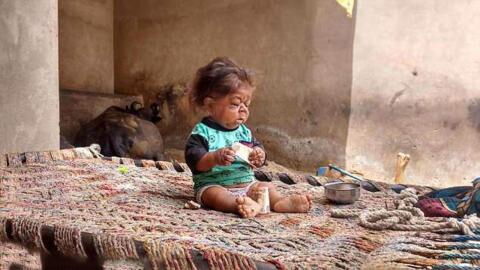 This 25-year-old man is trapped in a baby’s body