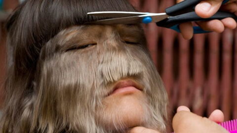 This is what the 'world's hairiest girl' looks like now