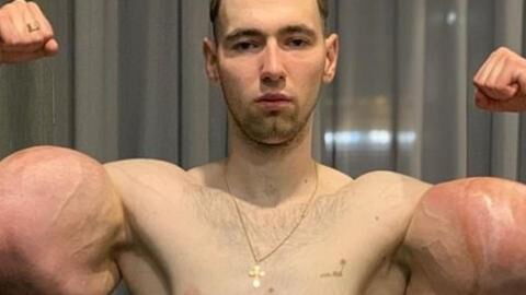 The 'synthol kid' is giving up his popeye like arms