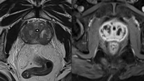 Man almost dies after having a 15 inch eel removed from his anus