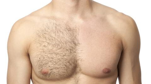 Boy loses both nipples in classroom dare