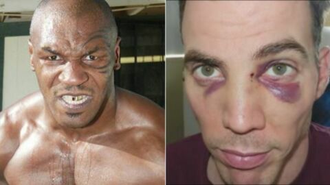 The Hilarious Moment Mike Tyson Broke Jackass Steve-O’s Nose on Live TV!